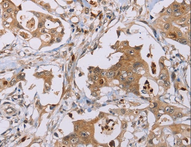 OTC Antibody
