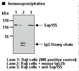 SF3B1 Antibody (clone 16)