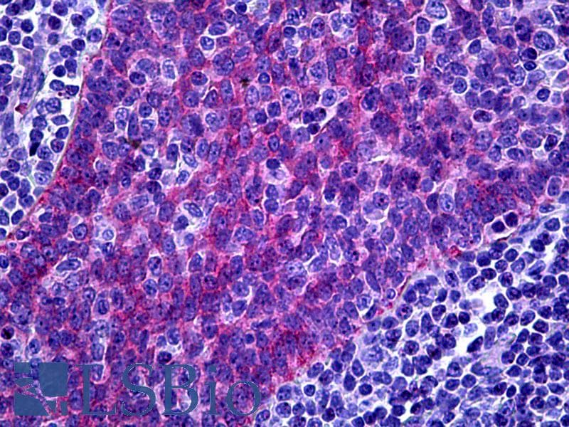 IHC-plus™ FREM1 Antibody
