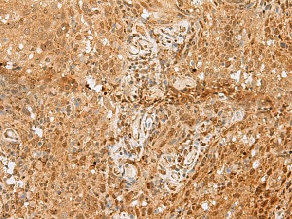 PNRC2 Antibody