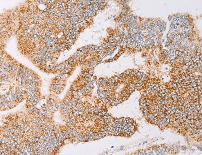 YARS2 Antibody
