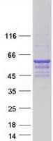 Human SEPT9 / Septin 9 Protein (Recombinant Myc-DDK (Flag))