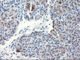 TBC1D21 Antibody (clone OTI2A6, Carrier-free)