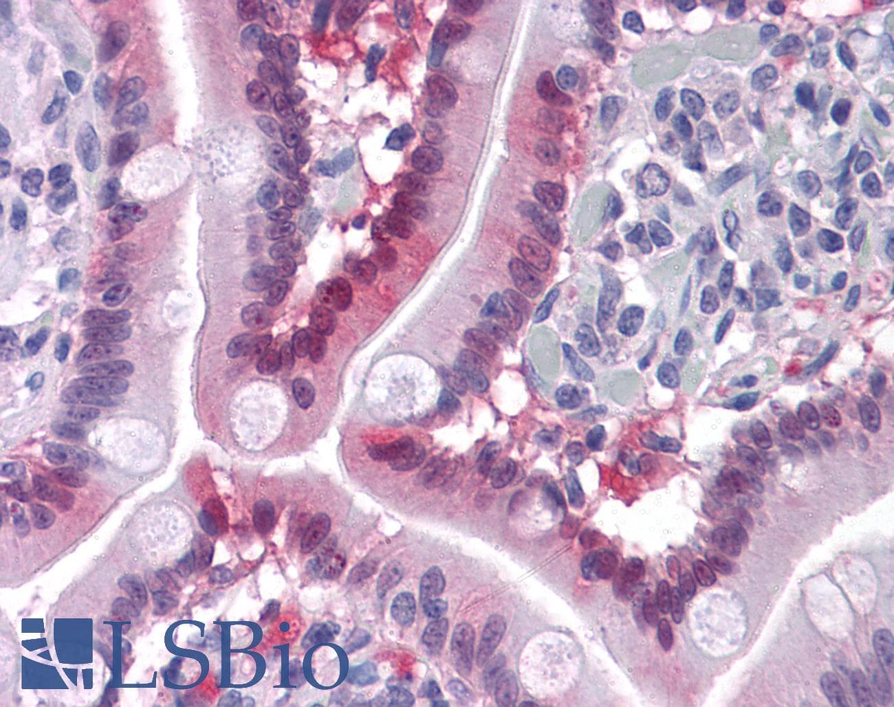 IHC-plus™ I-FABP / FABP2 Antibody (clone 9A9B7B3)