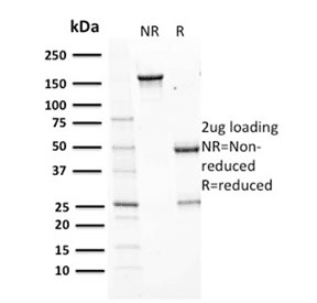 AURKB / Aurora-B Antibody (clone AURKB/1593, Azide-free, BSA-free)