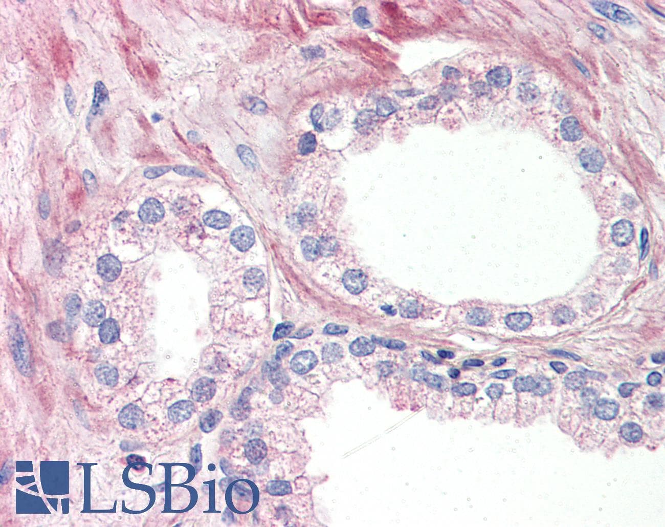 IHC-plus™ OR51E1 Antibody (Internal)