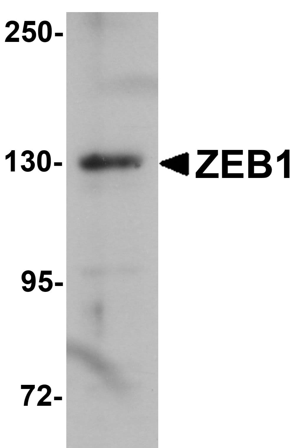ZEB1 / AREB6 Antibody