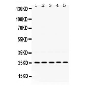 Polyclonal Rabbit anti-Human PGRMC1 / MPR Antibody (aa67-102, IHC, WB)