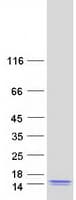 Human C2orf15 Protein (Recombinant Myc-DDK (Flag))