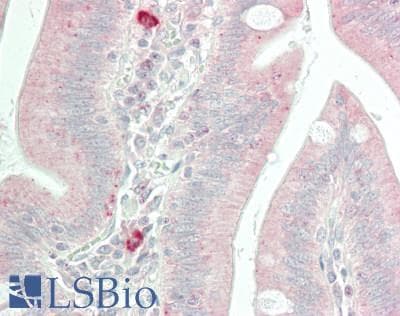IHC-plus™ CASP5 / Caspase 5 Antibody (aa102-151)