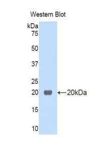 RNASE13 Antibody (aa20-156)