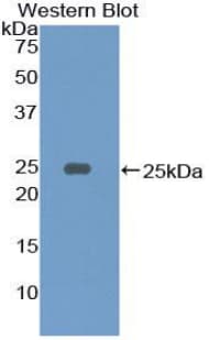 CD79A / CD79 Alpha Antibody (aa36-219, Cy3)