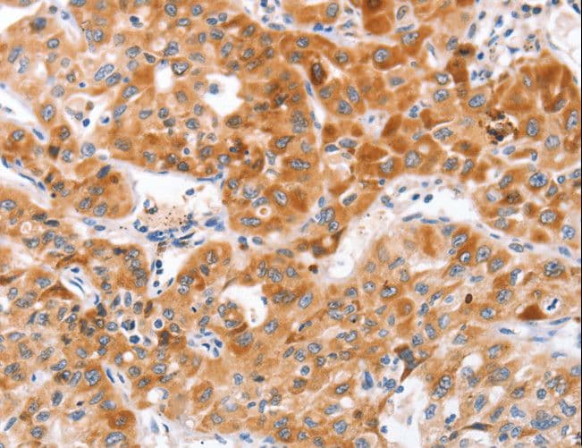 Polyclonal Rabbit anti-Human NOD1 Antibody (IHC)