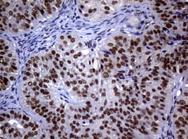 NBN / Nibrin Antibody (clone OTI9H2)