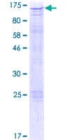 Human CIZ1 Protein (Recombinant GST)