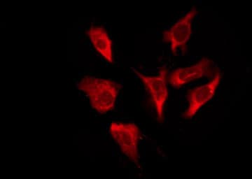 VIPR1 Antibody