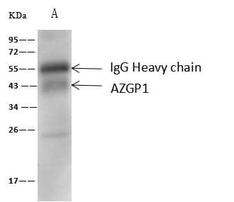 AZGP1 / ZAG Antibody (Preservative Free)