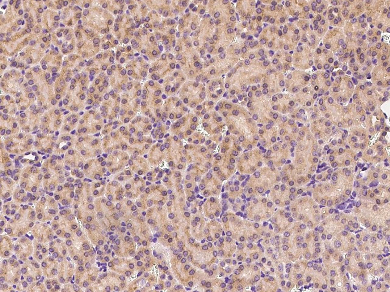 ITGAV/Integrin Alpha V/CD51 Antibody (Preservative Free)