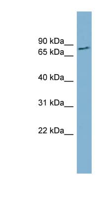 FURIN Antibody (aa107-156)