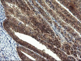 Monoclonal Mouse anti-Human Mannose Phosphate Isomerase Antibody (clone OTI1C7, Carrier-free, IHC, IF, WB)