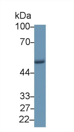 CORO1A / Coronin 1a Antibody (aa1-204)
