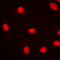 Polyclonal Rabbit anti-Human MZF / MZF1 Antibody (N-Terminus, IHC, IF, WB)