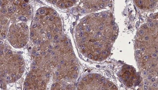 NPHS1 / Nephrin Antibody