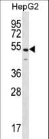 Polyclonal Rabbit anti-Human NKAP Antibody (aa387-415, WB)