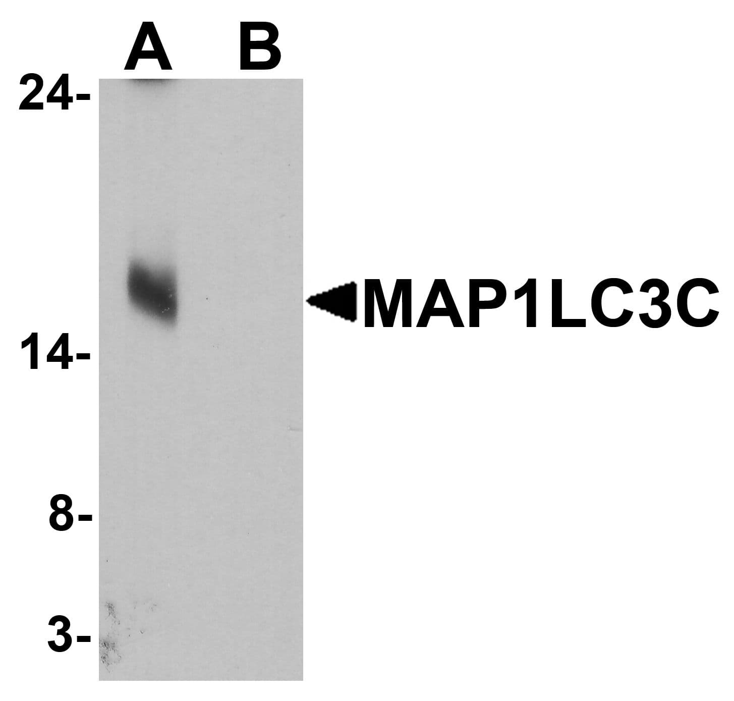 IHC-plus™ Polyclonal Rabbit anti-Human MAP1LC3C / LC3C Antibody (IHC, IF, WB)