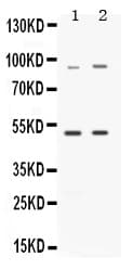 MAP3K8 / TPL2 Antibody
