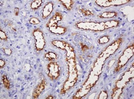 EMA / MUC1 Antibody (clone OTI3A7)
