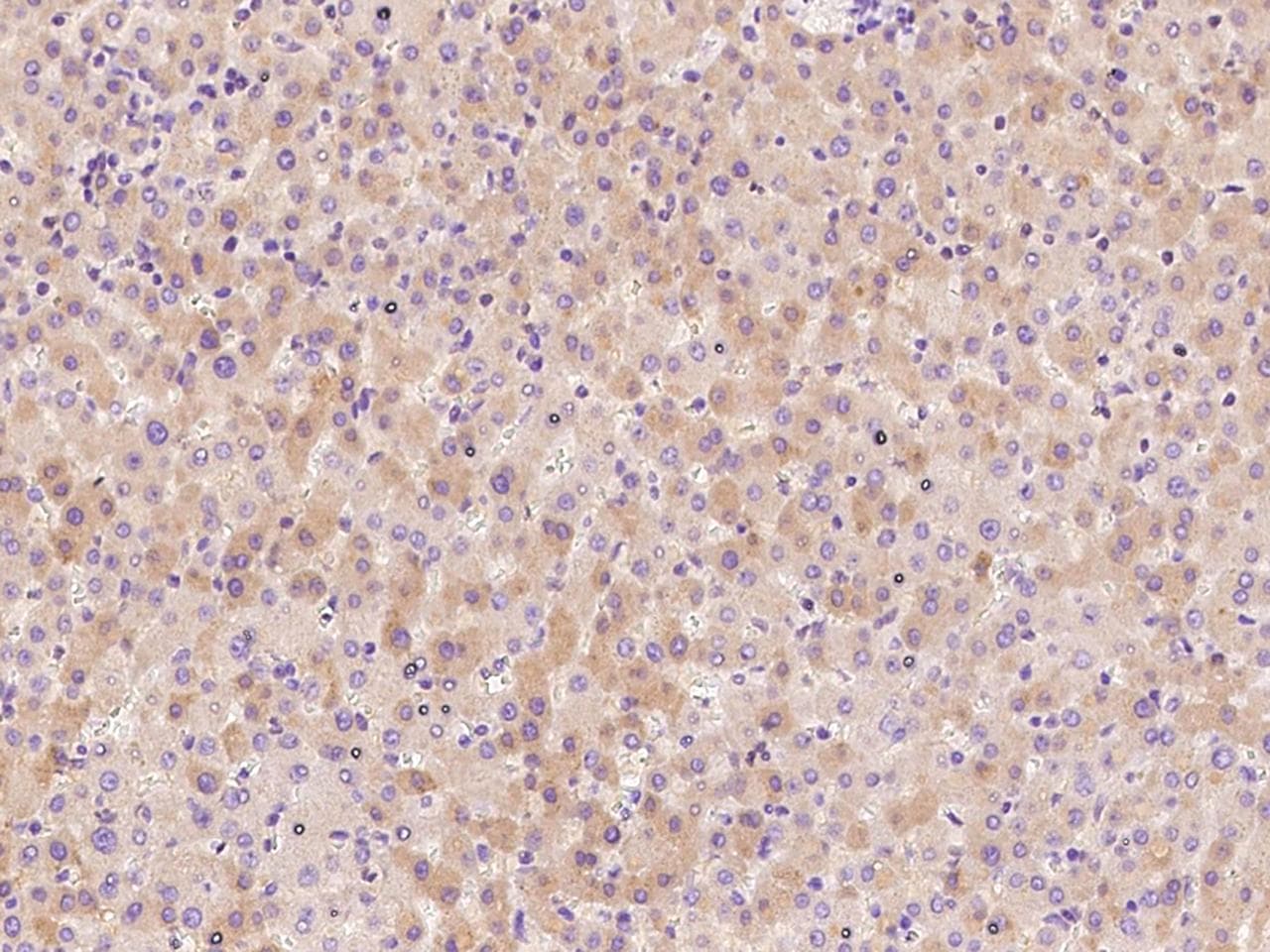 Antithrombin-III Antibody