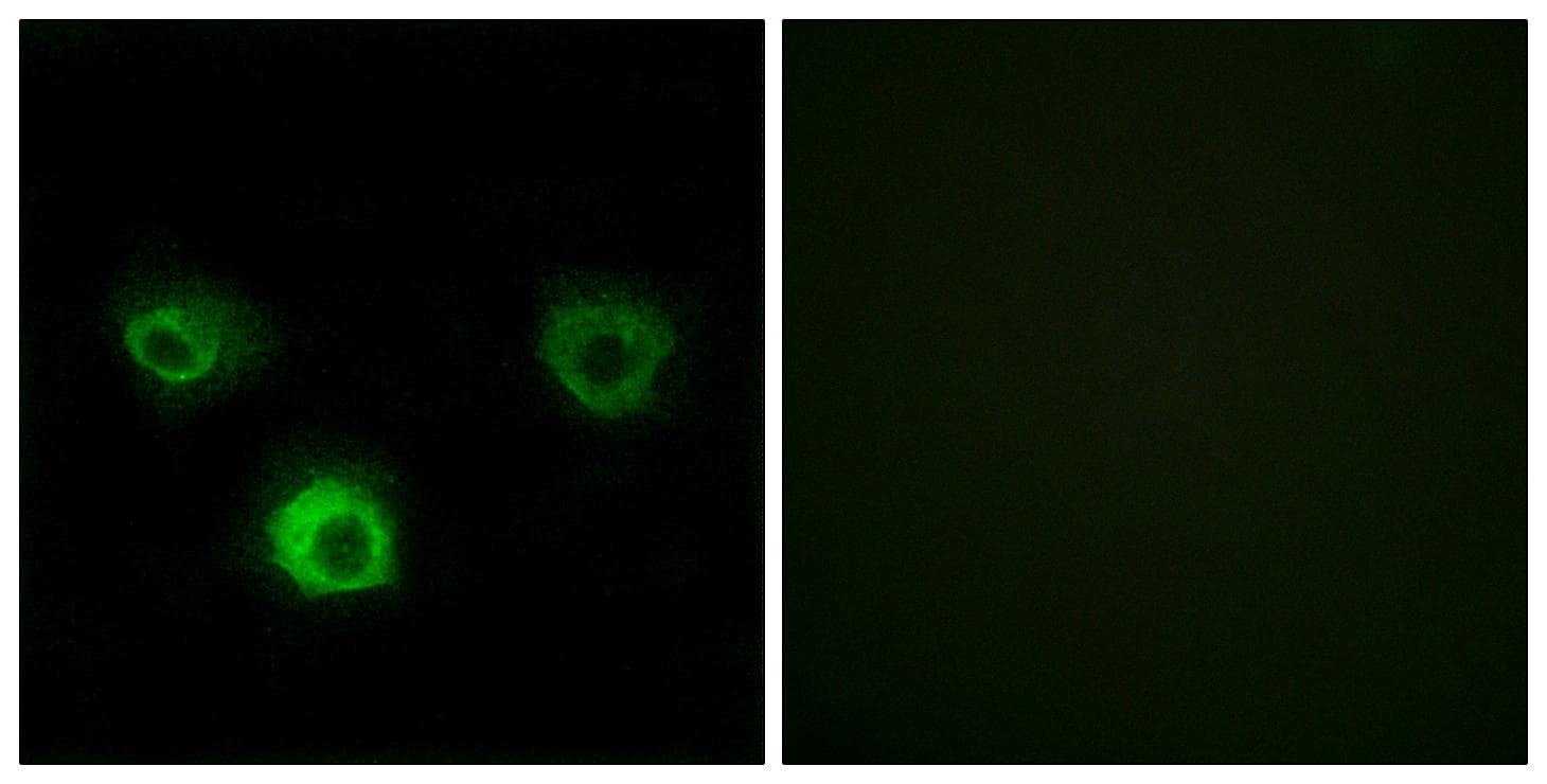 Polyclonal Rabbit anti-Human CCR4 Antibody (IF)