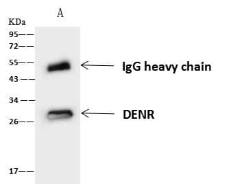 Polyclonal Rabbit anti-Human DENR / Density Regulated Antibody (IHC, IF, WB)