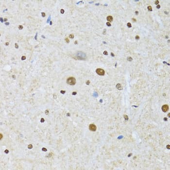 MTA3 Antibody