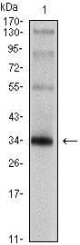 SYP / Synaptophysin Antibody (clone 7H12)
