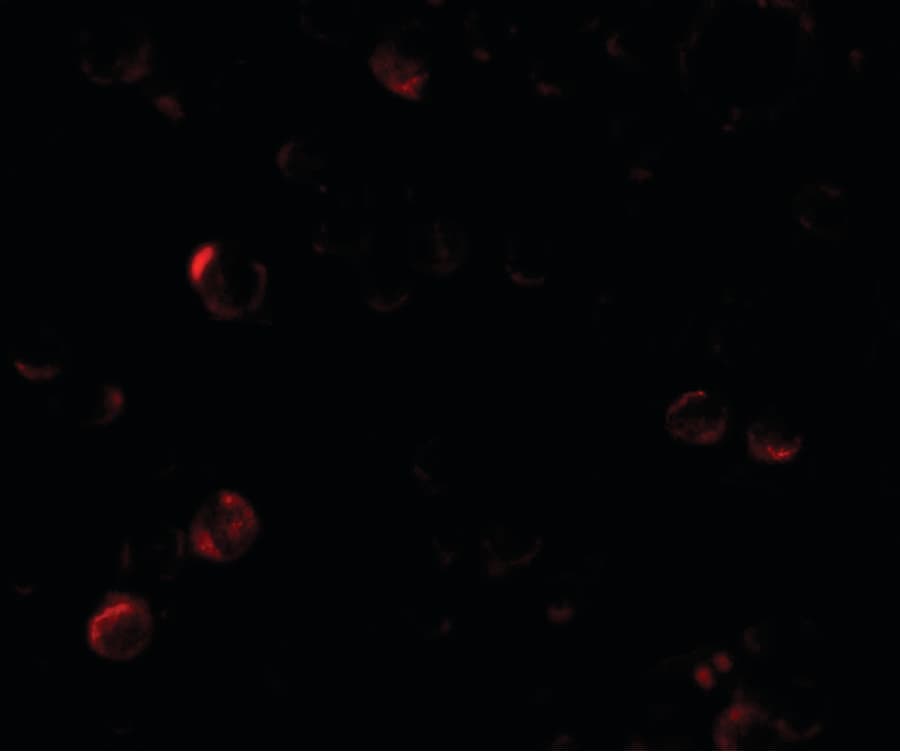 IHC-plus™ Polyclonal Rabbit anti-Human EPM2A / Laforin Antibody (IHC, IF, WB)