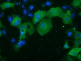 PRKD2 / PKD2 Antibody (clone OTI5G1)