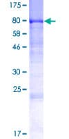 Human DENND1A Protein (Recombinant GST)