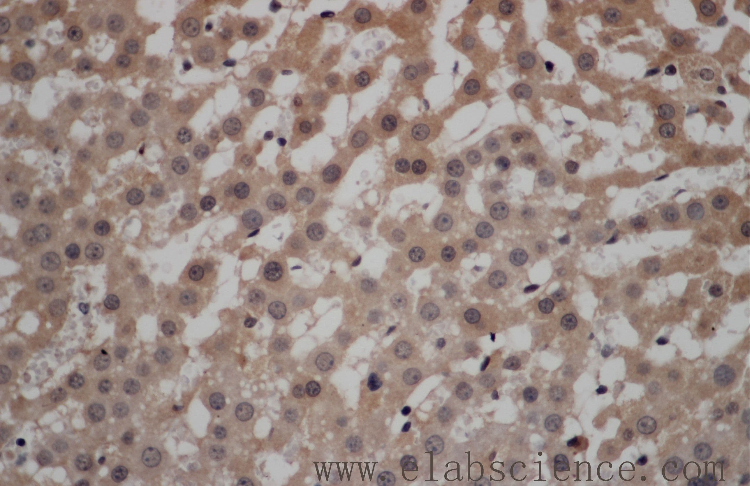 CALCRL / CGRP Receptor Antibody