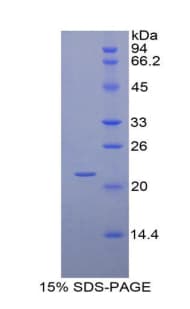 Pig IGFBP1 Protein (Recombinant His-T7)