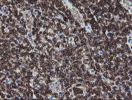 DEF6 Antibody (clone OTI2C11)