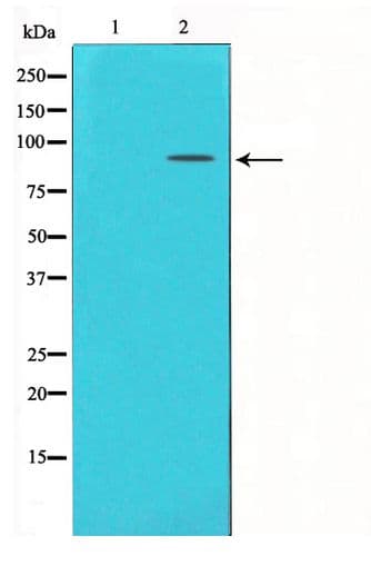 GLUR2 + GLUR3 Antibody