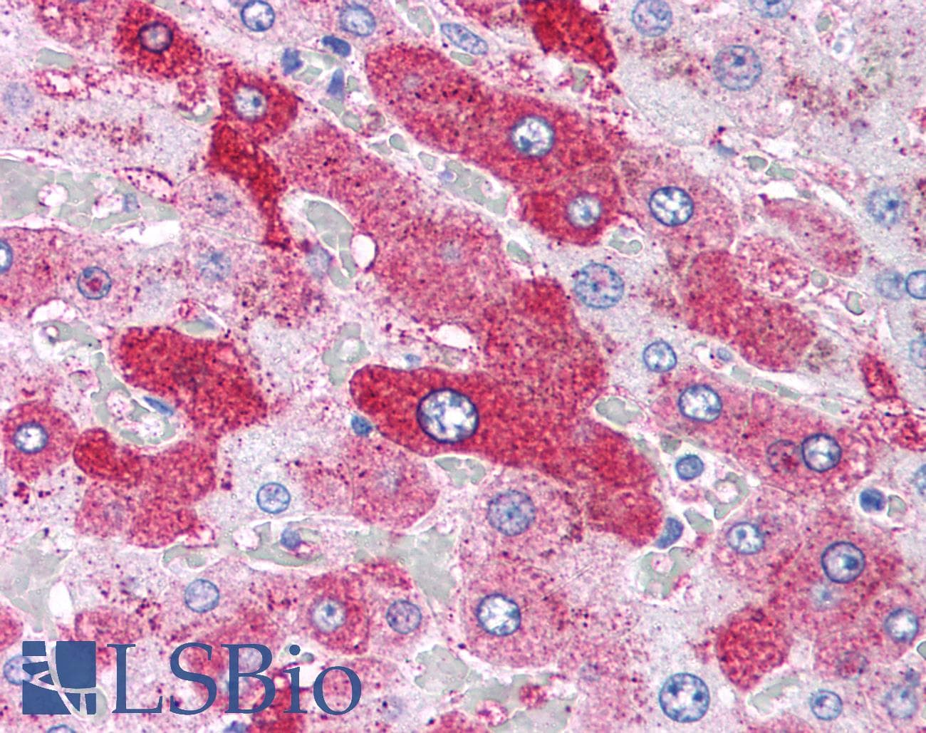 IHC-plus™ GCGR / Glucagon Receptor Antibody (N-Terminus)