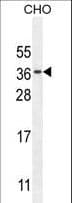 Polyclonal Rabbit anti-Human C11orf73 Antibody (aa6-35, IHC, WB)