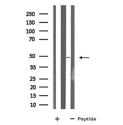 Polyclonal Rabbit anti-Human MAZ Antibody (WB)