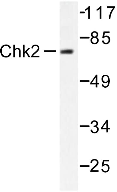 Polyclonal Rabbit anti-Human CHEK2 / CHK2 Antibody (Ser62, IHC, WB)