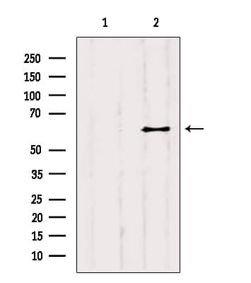 YTHDF2 Antibody