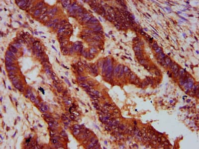 MOGAT1 / MGAT1 Antibody