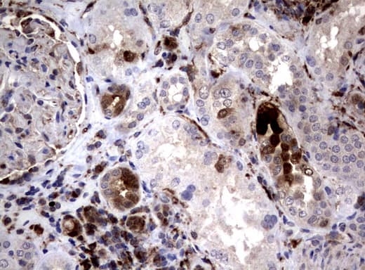 SDCBP / Syntenin Antibody (clone UMAB69, Carrier-free)